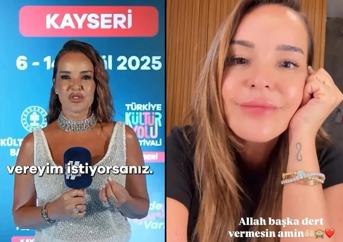 Bengü'nün yüzündeki değişim tartışılıyor