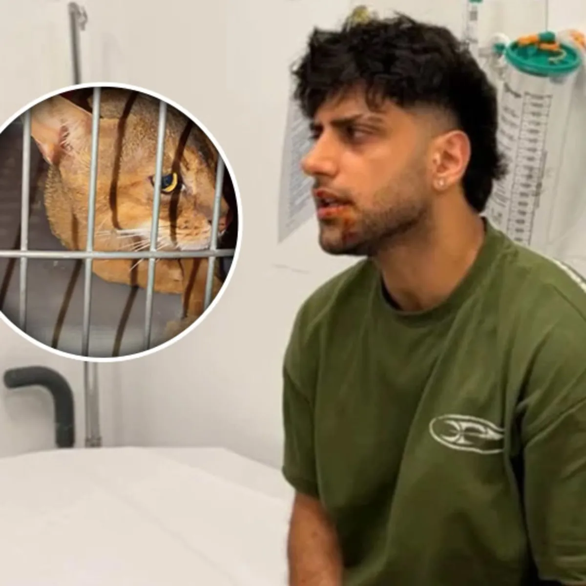 Rapçi Reynmen, evde beslediği kedi tarafından saldırıya uğradı.